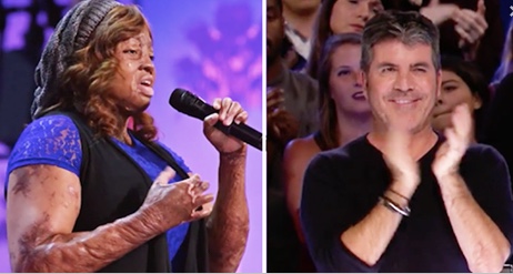 Plane Crash Survivor Endures 100 Surgeries, Then Wows Simon 10 Yrs Later In Heart-Wrenching Audition