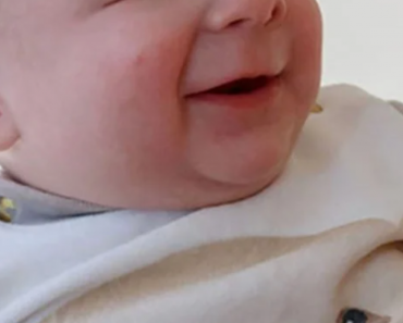 ‘Smiley’ Baby Born Without Eyes Finds Forever Home After Mom Abandoned Him