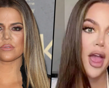 Khloe Kardashian Shocks Fans With ‘Pointy Chin and Nose’ In New Video