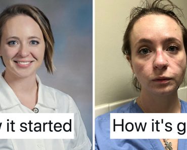 Nurse’s Before And After 2020 Picture Should Wake Us All Up