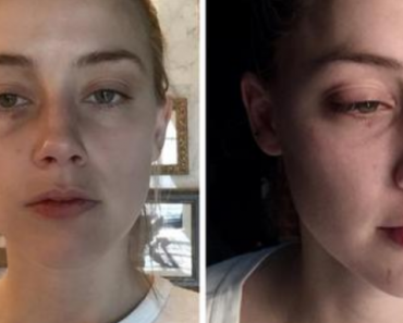 Johnny Depp attempts to prove Amber Heard assault photos are ‘fake’
