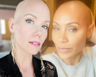 ‘Hollywood’s Bald Blonde’ Jannica Olin on Alopecia, Chris Rock’s Joke