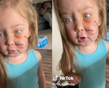 TikTok Mom Keeps Dog After It Mauled and Almost Killed Their Toddler